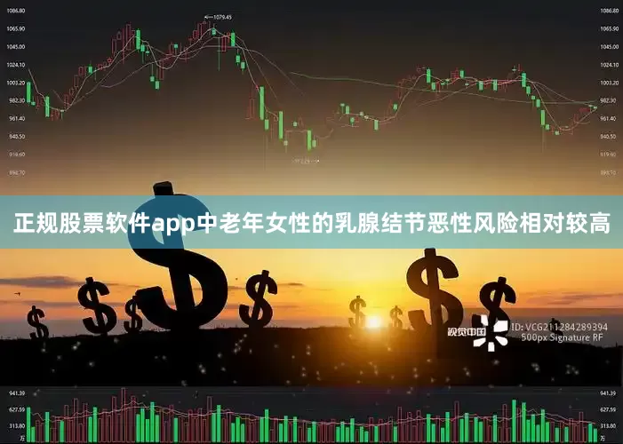 正规股票软件app中老年女性的乳腺结节恶性风险相对较高